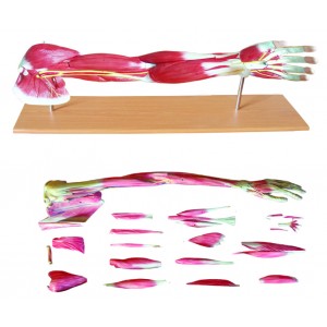 http://www.yuantech.de/283-608-thickbox/ya-l112-the-dissected-upper-limb-gradation-model.jpg