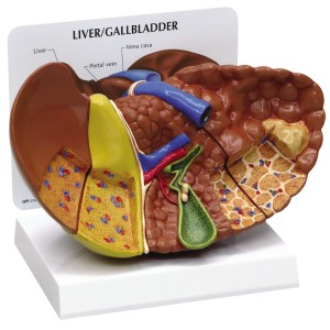 http://www.yuantech.de/318-631-thickbox/ya-d035a-diseased-liver-cancer-model-2.jpg