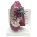 YA/R044 Lung Model 1 Part