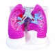 YA/R045 Diseased Lung Model
