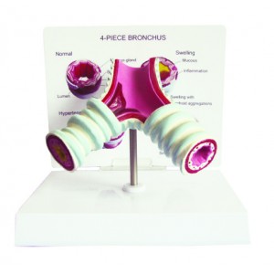 http://www.yuantech.de/345-652-thickbox/ya-r052a-diseased-tracheal-model-1-part.jpg