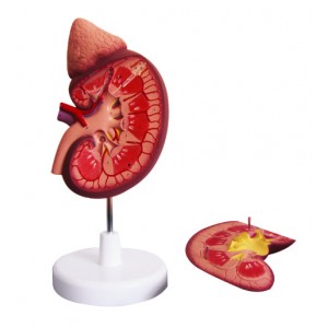http://www.yuantech.de/355-656-thickbox/ya-u022-kidney-with-adrenal-gland-2-parts.jpg