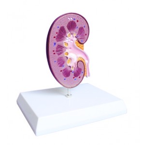 http://www.yuantech.de/360-661-thickbox/ya-u024-kidney-and-renal-calculus-model.jpg