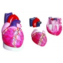 YA/C021 Enlarged Heart Model 3 Parts