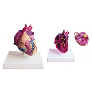 http://www.yuantech.de/419-705-thickbox/ya-c025-heart-hypertrophy-model.jpg