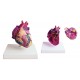 YA/C025 Heart Hypertrophy Model