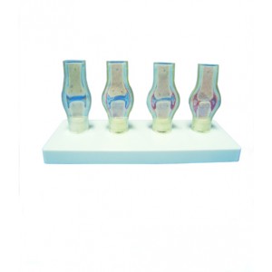 http://www.yuantech.de/558-829-thickbox/ya-p015-pathological-knee-joint-model.jpg