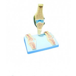 http://www.yuantech.de/561-832-thickbox/ya-p015c-rheumatic-knee-joint.jpg