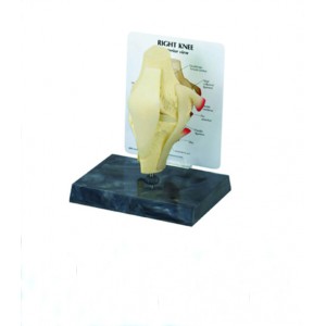 http://www.yuantech.de/563-834-thickbox/ya-p015e-knee-joint-with-ligaments.jpg