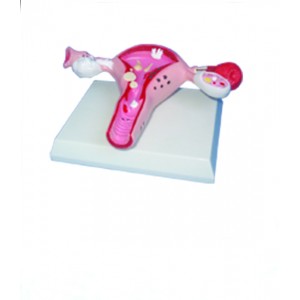 http://www.yuantech.de/567-838-thickbox/ya-p018-diseased-uterus-model.jpg