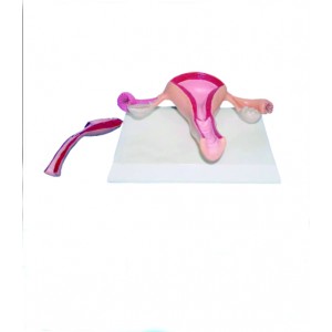 http://www.yuantech.de/568-839-thickbox/ya-p019-normal-uterus-model.jpg