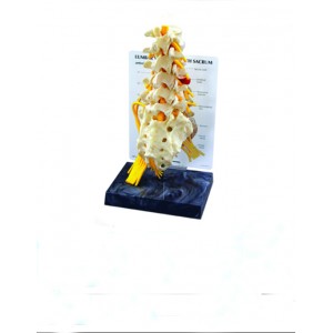 http://www.yuantech.de/588-859-thickbox/ya-p028-lumbar-sacrum-with-nerves.jpg